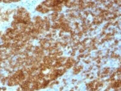 Immunohistochemistry-Paraffin: CD45RA Antibody (SPM568) - IHC-Prediluted [NBP2-44852]