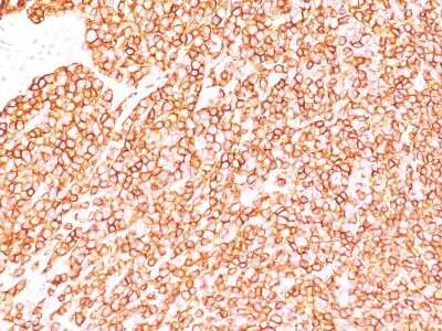 Immunohistochemistry-Paraffin: CD45RB Antibody (BRA-11 (same as BRA-11G)) [NBP2-33021]