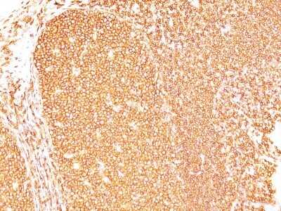 Immunohistochemistry-Paraffin: CD45RB Antibody (PD7/26) - Azide and BSA Free [NBP2-34708]
