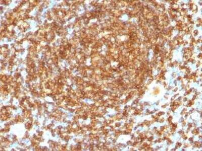 Immunohistochemistry-Paraffin: CD45RB Antibody (PTPRC/1132) - Azide and BSA Free [NBP2-47958]