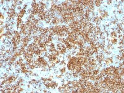 Immunohistochemistry-Paraffin: CD45RB Antibody (PTPRC/1132) [NBP2-44846]