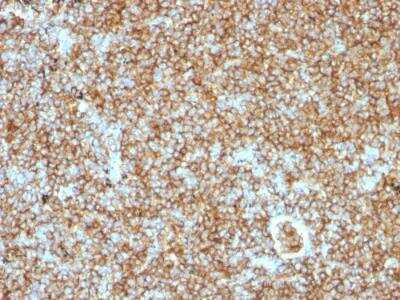 Immunohistochemistry-Paraffin: CD45RB Antibody (PTPRC/1147) - Azide and BSA Free [NBP2-47959]