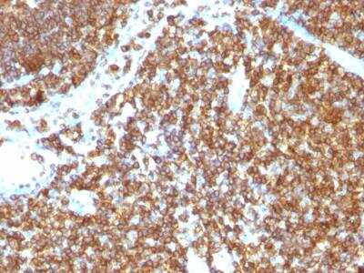 Immunohistochemistry-Paraffin: CD45RB Antibody (PTPRC/1147) - Azide and BSA Free [NBP2-47959]