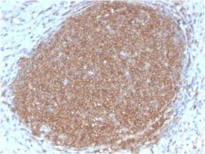 Immunohistochemistry-Paraffin: CD45RB Antibody (PTPRC/2877R) - Azide and BSA Free [NBP3-08924]
