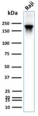 Western Blot: CD45RB Antibody (PTPRC/2877R) [NBP3-07180]