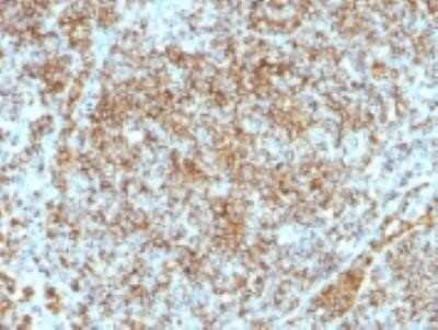 Immunohistochemistry-Paraffin: CD45RB Antibody (SPM569) - IHC-Prediluted [NBP2-44856]