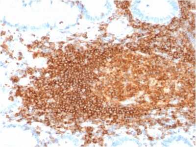 Immunohistochemistry-Paraffin: CD45RB Antibody (rPTPRC/1132) - Azide and BSA Free [NBP3-08909]