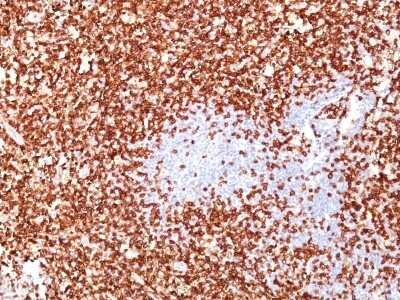Immunohistochemistry-Paraffin: CD45RO Antibody (UCHL-1 + T200/797) - Azide and BSA Free [NBP2-54314]