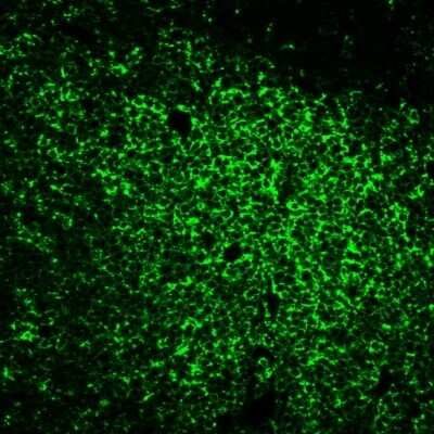 Immunocytochemistry/ Immunofluorescence: CD45RO Antibody (UCHL-1) [NBP2-29631]