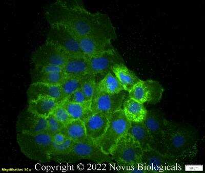 Immunocytochemistry/ Immunofluorescence: CD47 Antibody (B6H12.2) - Azide and BSA Free [NBP2-31106]