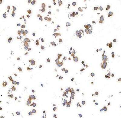 Immunocytochemistry: CD47 Antibody (BLR131H) [NBP3-14713]
