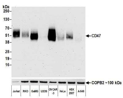 Western Blot: CD47 Antibody (BLR131H) [NBP3-14713]