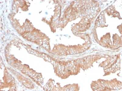 Immunohistochemistry-Paraffin: CD47 Antibody (CD47/3019) - Azide and BSA Free [NBP3-08976]
