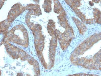 Immunohistochemistry-Paraffin: CD47 Antibody (CD47/3019) - Azide and BSA Free [NBP3-08976]