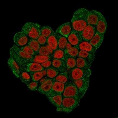 Immunocytochemistry/ Immunofluorescence: CD47 Antibody (CD47/3019) [NBP3-08975]