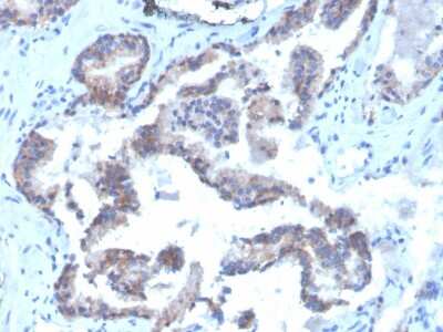 Immunohistochemistry-Paraffin: CD47 Antibody (CD47/3019) [NBP3-08975]