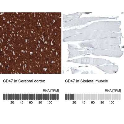 Immunohistochemistry-Paraffin: CD47 Antibody (CL6913) [NBP2-76511]