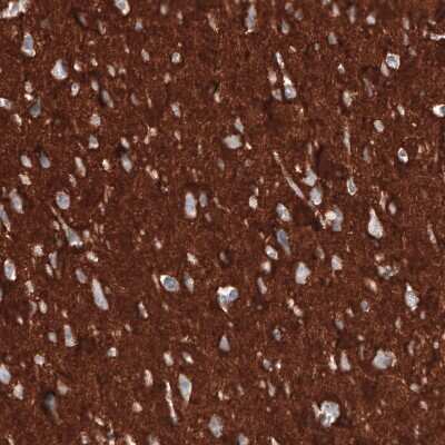 Immunohistochemistry-Paraffin: CD47 Antibody (CL6913) [NBP2-76511]