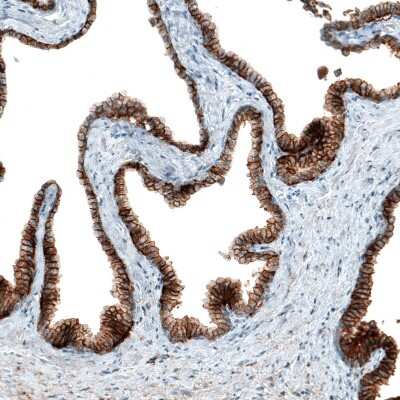 Immunohistochemistry-Paraffin: CD47 Antibody (CL6913) [NBP2-76511]
