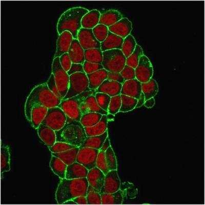 Immunocytochemistry/ Immunofluorescence: CD47 Antibody (IAP/964) - Azide and BSA Free [NBP3-08974]