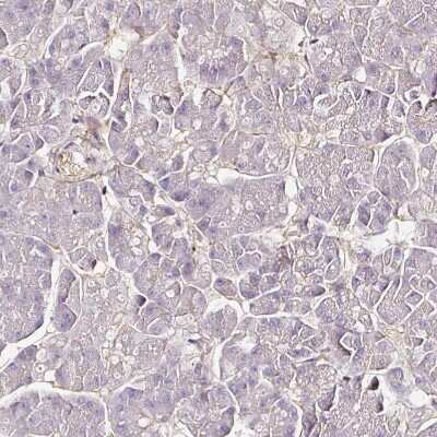 Immunohistochemistry-Paraffin: CD47 Antibody [NBP2-32031]