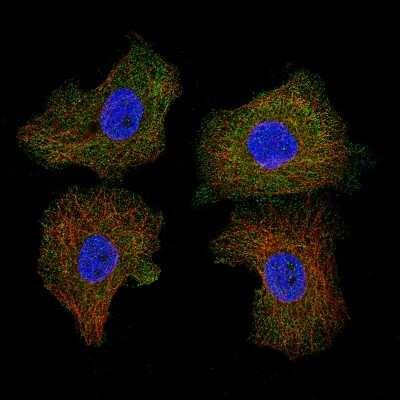 Immunocytochemistry/ Immunofluorescence: CD5 Antibody (CL12334) [NBP3-15133]
