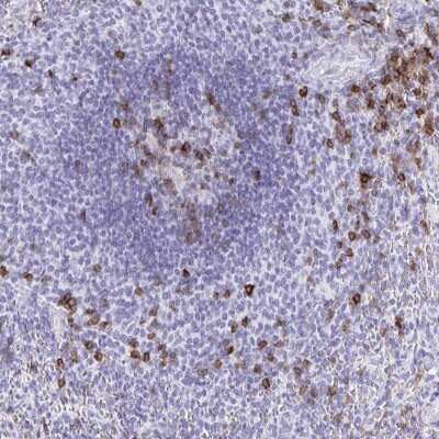Immunohistochemistry: CD5 Antibody [NBP2-38900]