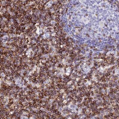 Immunohistochemistry-Paraffin: CD5 Antibody [NBP2-38509]