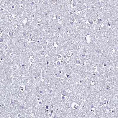 Immunohistochemistry-Paraffin: CD5 Antibody [NBP2-38509]