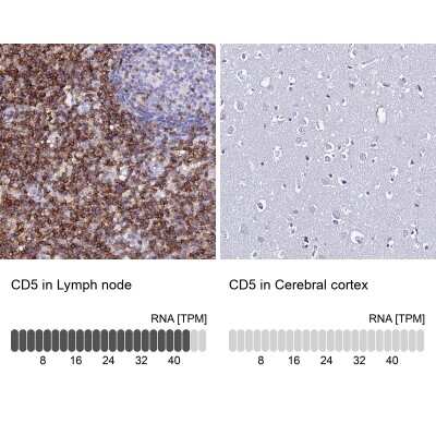 Immunohistochemistry-Paraffin: CD5 Antibody [NBP2-38509]