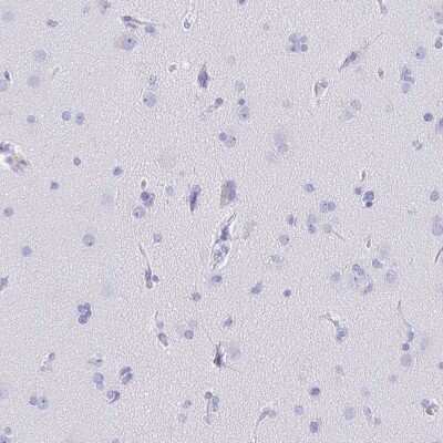 Immunohistochemistry-Paraffin: CD5 Antibody [NBP2-38900]