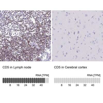Immunohistochemistry-Paraffin: CD5 Antibody [NBP2-38900]