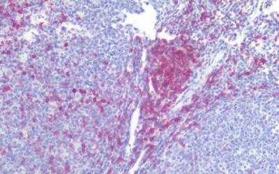 Immunohistochemistry-Paraffin: CD5 Antibody (L17F12) - BSA Free [NBP3-09129]