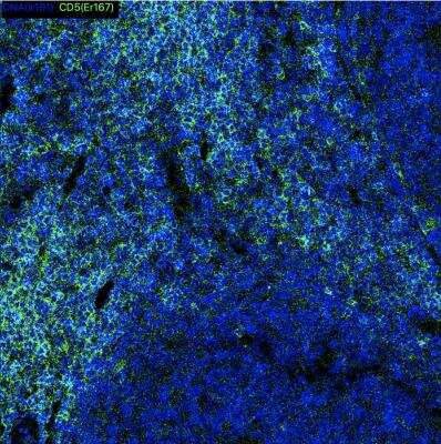 Imaging Mass Cytometry: CD5 Antibody (OTI7A7) - Azide and BSA Free [NBP2-70360]
