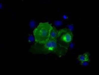 Immunocytochemistry/ Immunofluorescence: CD5 Antibody (OTI7A7) - Azide and BSA Free [NBP2-70360]