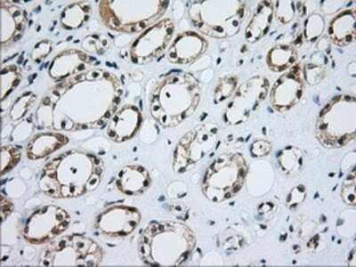 Immunohistochemistry: CD5 Antibody (OTI7A7) - Azide and BSA Free [NBP2-70360]