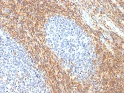 Immunohistochemistry-Paraffin: CD52 Antibody (CD52/2276R) [NBP3-07424]
