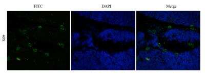 Immunofluorescence: CD52 Antibody (Campath-1H) - Azide and BSA Free [NBP2-75896]