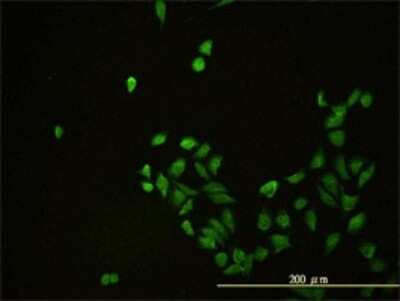 Immunocytochemistry/ Immunofluorescence: CD58/LFA-3 Antibody (2D11-B10) [H00000965-M01]