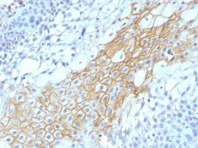 Immunohistochemistry-Paraffin: CD59 Antibody (MACIF/1193) - IHC-Prediluted [NBP2-48467]