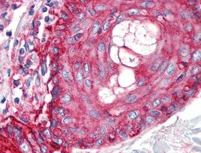 Immunohistochemistry-Paraffin: CD59 Antibody (MEM-43/5) - BSA Free [NB500-400]