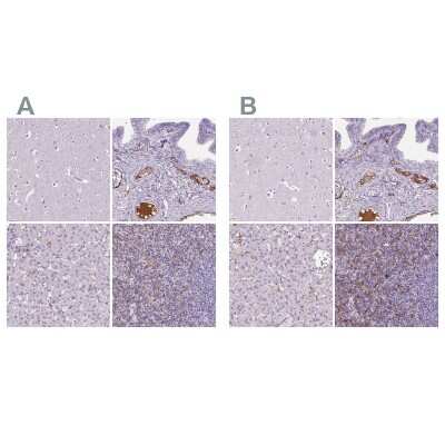 Immunohistochemistry-Paraffin: CD5L Antibody [NBP2-39094]