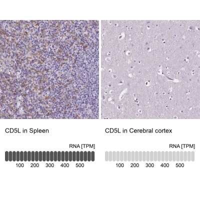 Immunohistochemistry-Paraffin: CD5L Antibody [NBP2-39094]