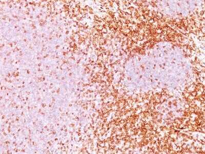 Immunohistochemistry-Paraffin: CD6 Antibody (3F7B5) - IHC-Prediluted [NBP2-44553]