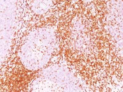 Immunohistochemistry-Paraffin: CD6 Antibody (3F7B5) - IHC-Prediluted [NBP2-44553]