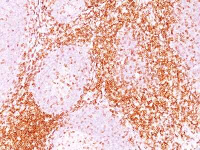 Immunohistochemistry-Paraffin: CD6 Antibody (3F7B5) [NBP2-32942]