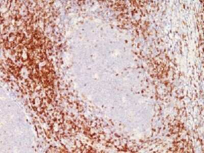 Immunohistochemistry-Paraffin: CD6 Antibody (C6/372+3F7B5) [NBP2-34317]