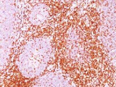 Immunohistochemistry-Paraffin: CD6 Antibody (C6/372) [NBP2-32827]