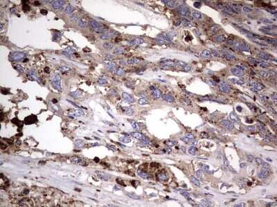 Immunohistochemistry: CD63 Antibody (OTI5E5) [NBP2-46167]