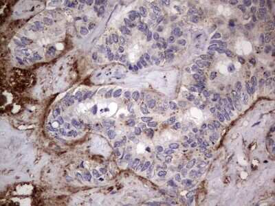 Immunohistochemistry: CD63 Antibody (OTI5E5) [NBP2-46167]